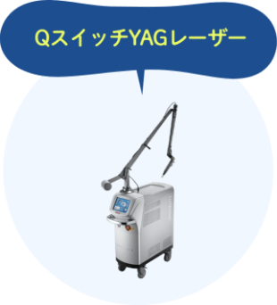 QスイッチYAGレーザー